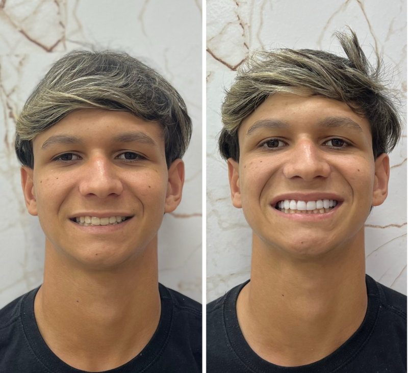 Antes e Depois - Transformação 2
